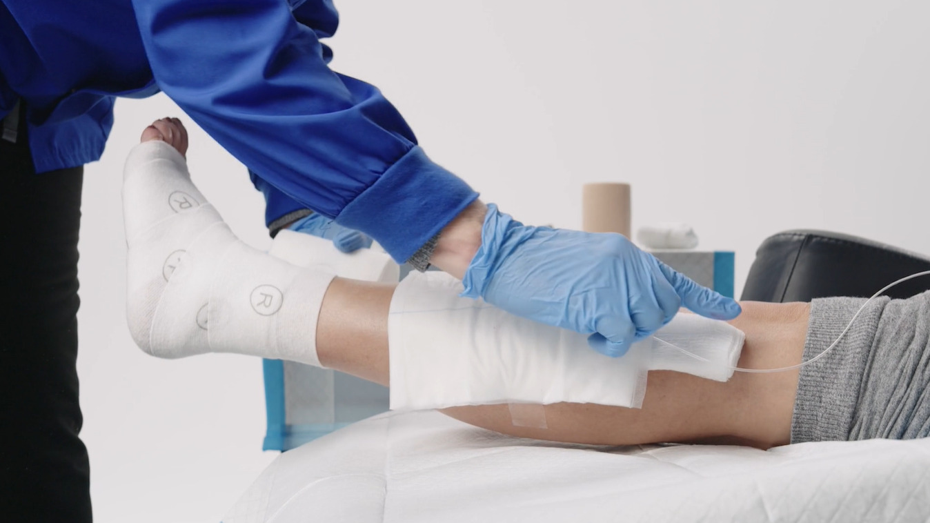 How to apply the NATROX® O₂ device for treating venous leg ulcers (VLU).