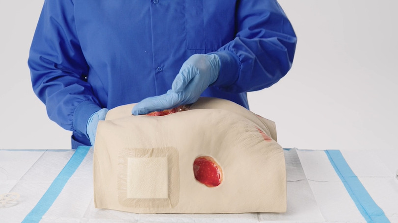 How to apply the NATROX® O₂ device for treating pressure injuries